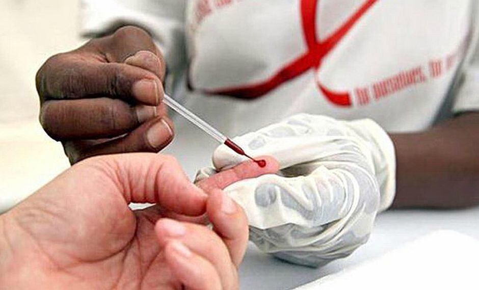 VIH y Sida: ¿Cuál es la diferencia?