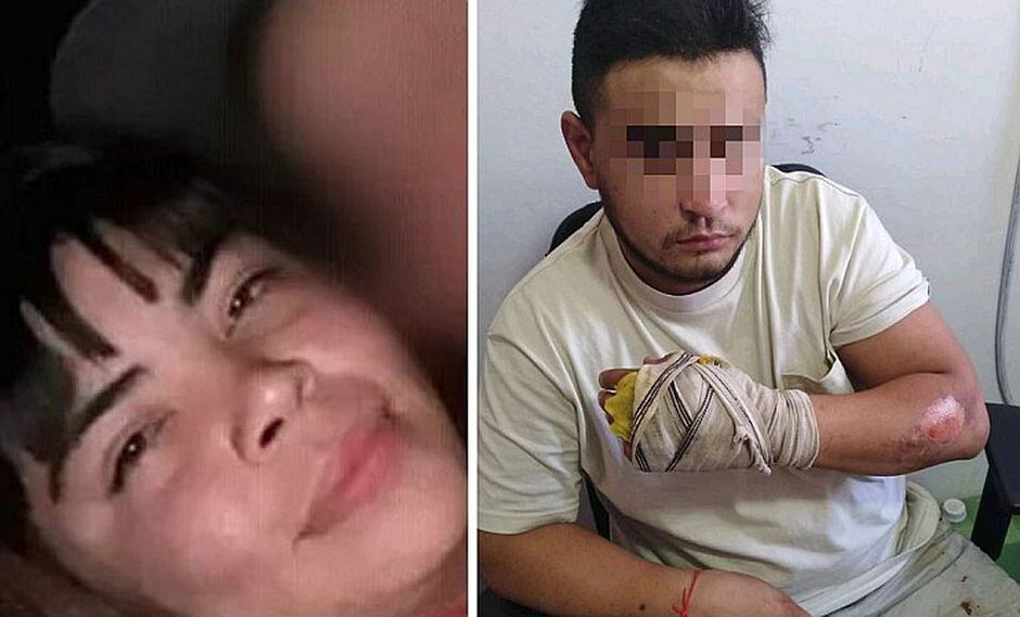 Mujer es quemada por su pareja, se tira a piscina, pero muere 15 días después