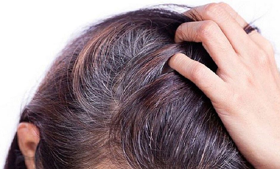 ¿Tienes canas prematuras? ¡Cuidado! Tu cuerpo te puede estar alertando de una enfermedad
