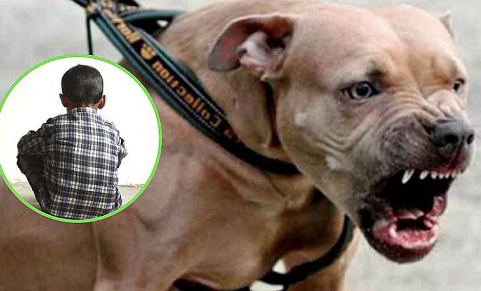 Perros pitbull destrozan rostro de niño y necesita ser trasladado a Lima (FOTO)