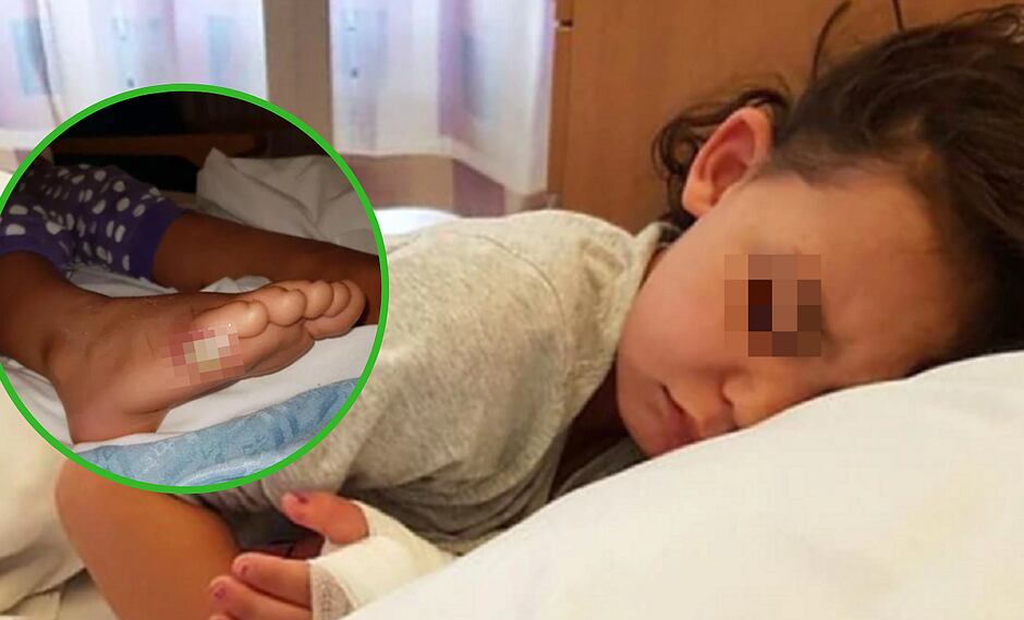 Niña de 4 años probó unos zapatos sin ponerse medias y sufre una infección mortal