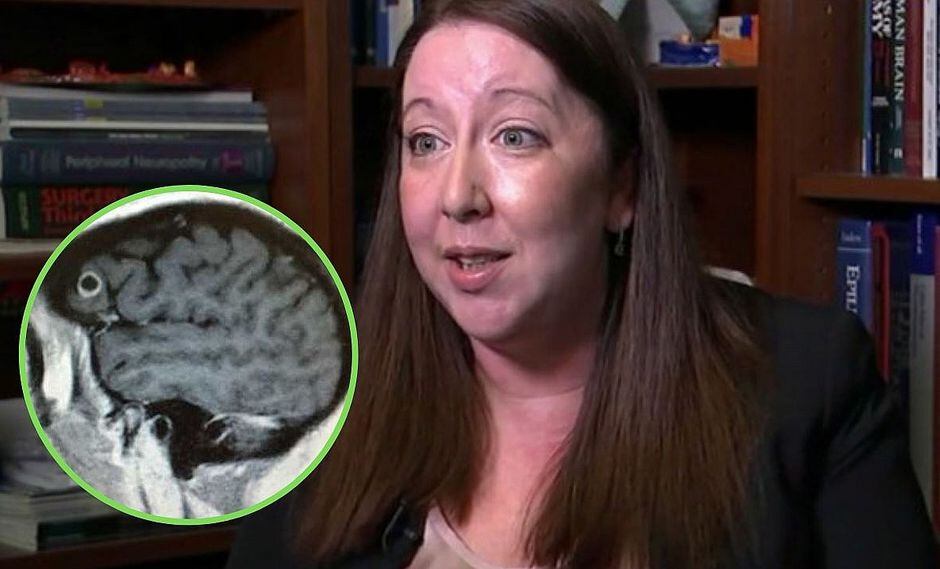 Mujer es diagnosticada con cáncer en el cerebro, pero descubren que tenía un gusano