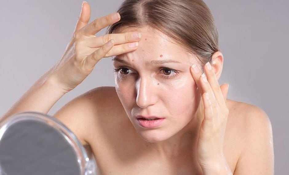 8 formas prácticas de eliminar el acné en la etapa adulta