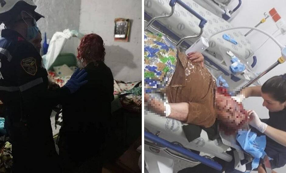 Ladrones golpean brutalmente a abuelita de 87 años y le roban hasta los dientes postizos