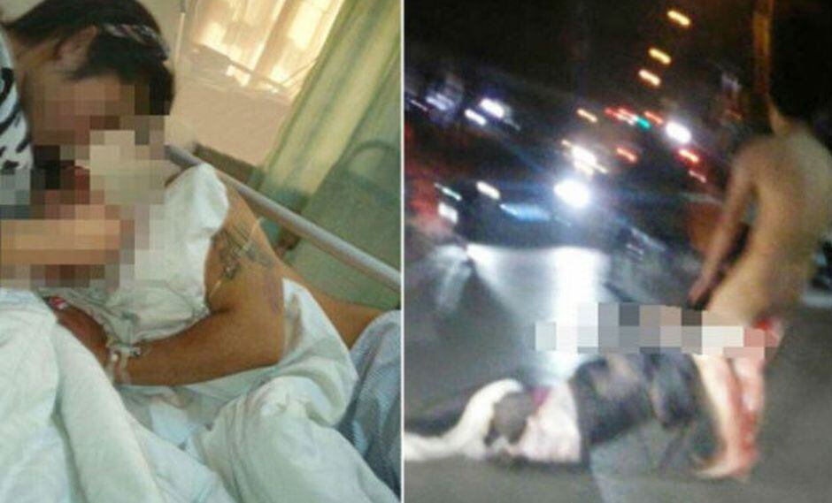 Mujer le corta pene a infiel y tras ser reconstruido lo vuelve a mutilar