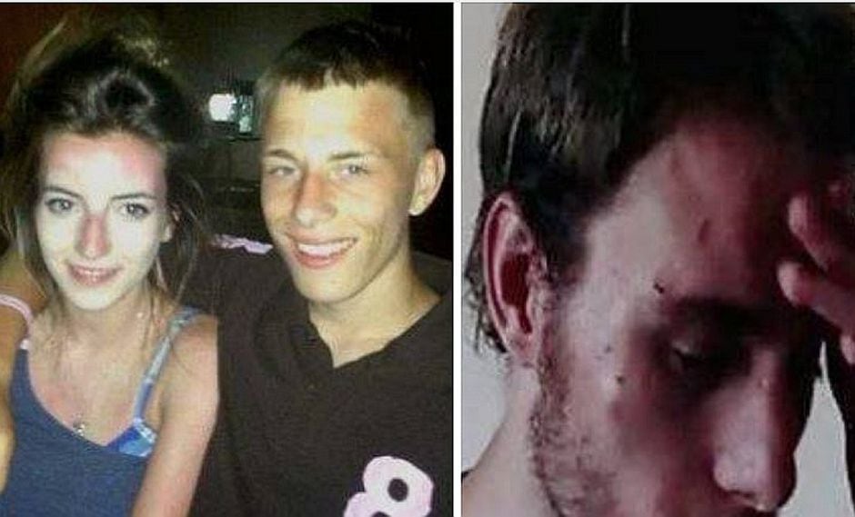 Hombre sufrió maltrato de su novia al punto que tenía miedo de morir (FOTOS)