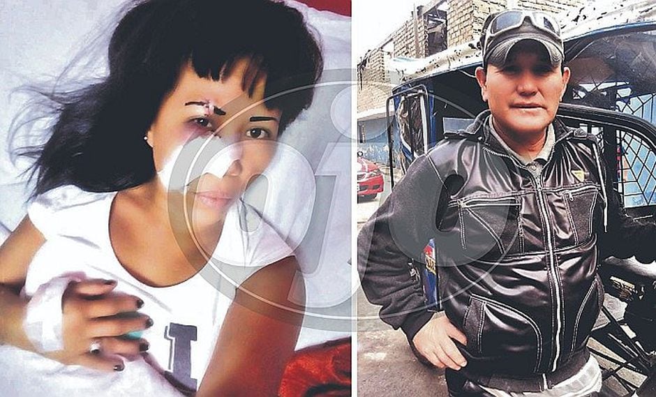 Mujer dormía con su nueva pareja, su ex llegó y los atacó con botella rota y machete