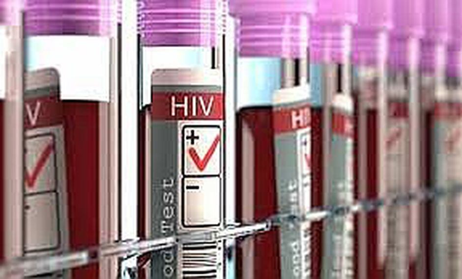Implante subcutáneo y vacuna son nuevos métodos para prevenir el VIH