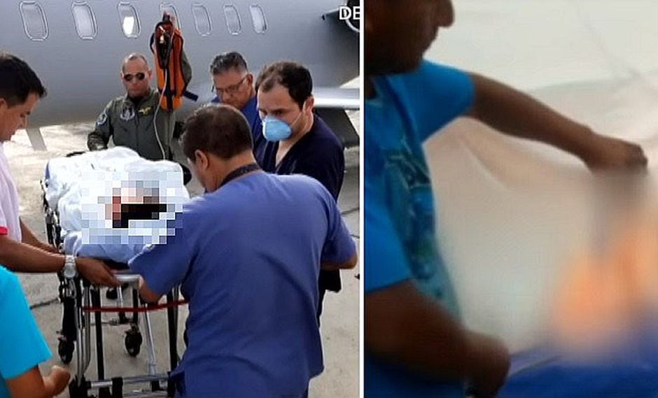 Niño cayó en olla de chicha de jora hirviendo y necesita ayuda (VIDEO)