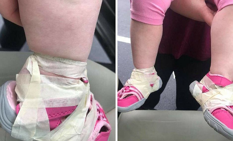 Pies de niña son envueltos con cinta para evitar que se quite los zapatos (FOTOS)