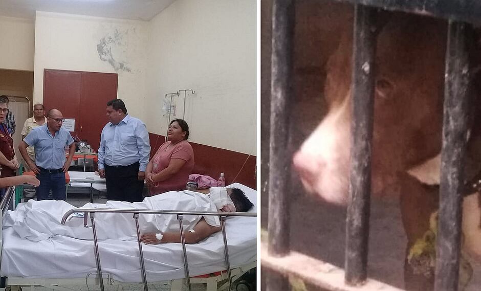 Dejan en libertad a dueña de pitbull que desfiguró a pequeño de 11 años