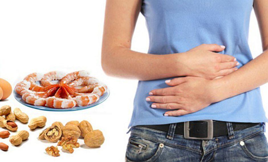 ¿Reacciones alérgicas o intolerancia alimentaria? Conoce la diferencia