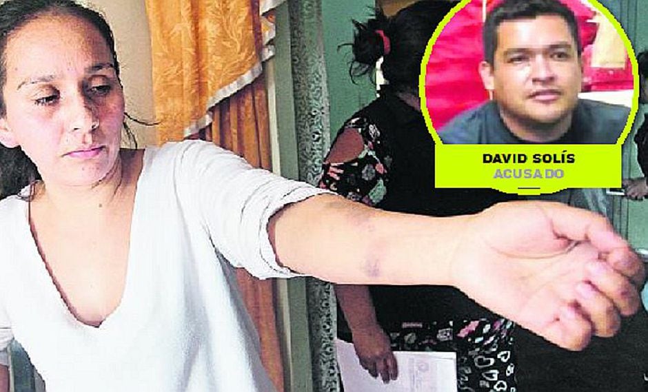 Exconviviente le rompe el tabique a mujer en Carabayllo y no fue detenido