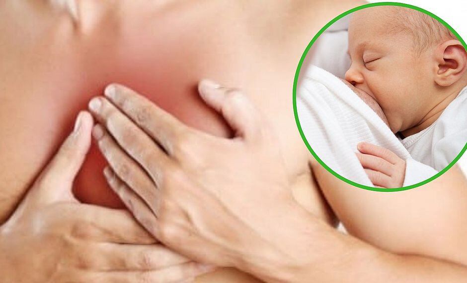 El extraño síndrome que puede producir leche en los hombres