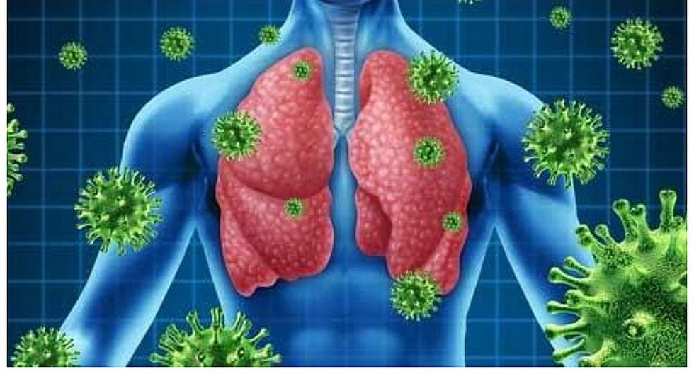 Las infecciones respiratorias agudas | Salud | Ojo