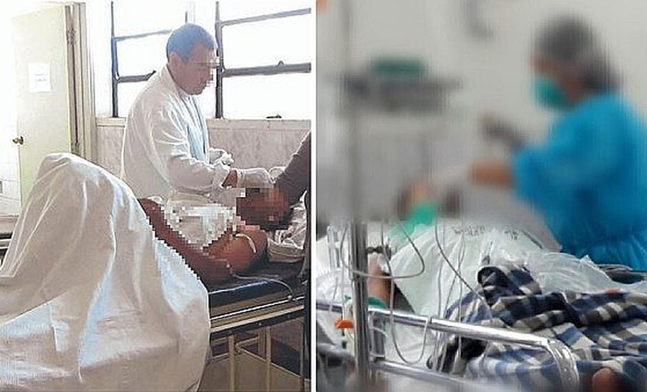 Guillain-Barré cobra su cuarta víctima en el Perú