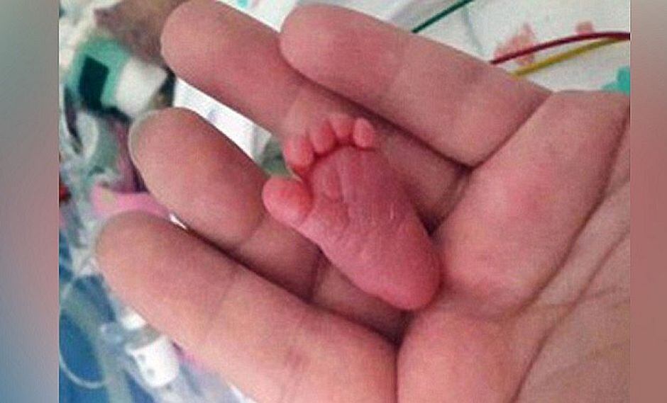 Bebé es herido con bisturí en el rostro durante cesárea, mientras mamita falleció